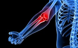 orthopedic elbow surgery naples