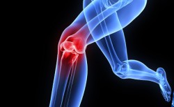 orthopedic knee surgery naples